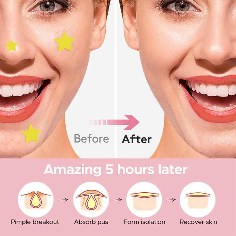 600 sztuk/zestaw Plasterki na  – Beauty With Makeup recenzja i cena